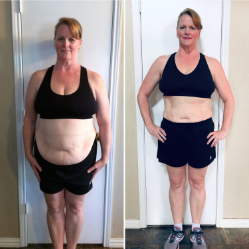 Margaret L. before and after Gumitide